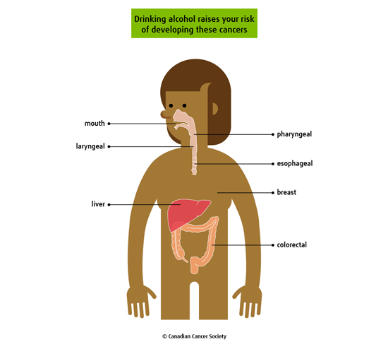 Cancer risk of alcohol consumption infographic